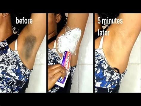 I have also recently started exfoliating my underarms to see if it helps. In 5 Minutes Lightening Dark Underarm Challenge With Rice ...