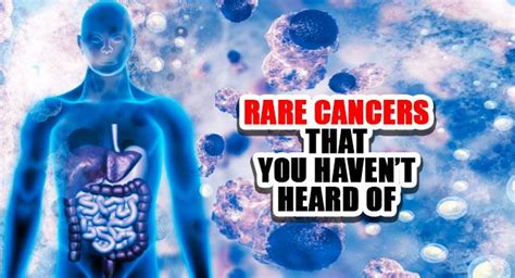 rare types of cancer and their symptoms you should know