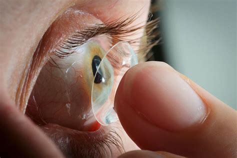 Woman Has A Contact Lens Stuck In Her Eye For 28 Years