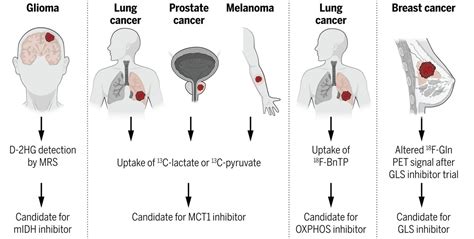 Metabolic Reprogramming And Cancer Progression Science