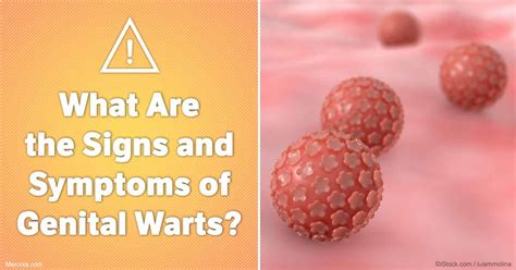 What Are The Signs And Symptoms Of Genital Warts