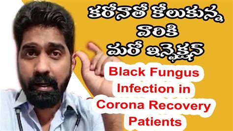 Black Fungus Mucormycosis The Black Fungus Maiming Covid Patients
