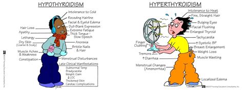 Hyperthyroidism Vs Hypothyroidism The Issues Of Hyperthyroidism
