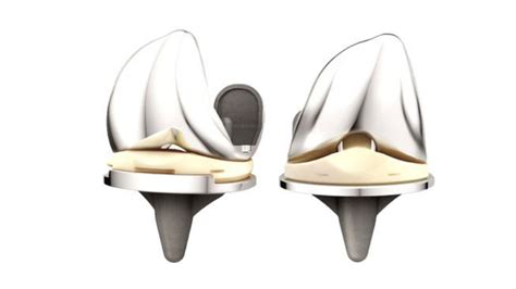Depuy Hip Implants And What To Do If You Have One