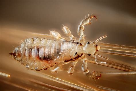 Human Head Lice What You Need To Know Massey Services Inc