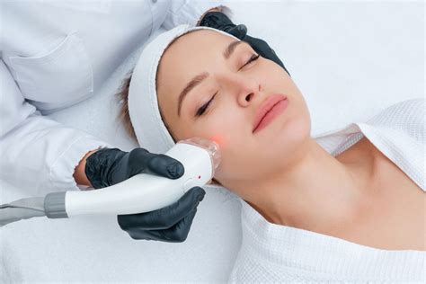 Why Microneedling With Rf Lazaderm