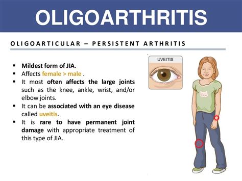 Juvenile Idiopathic Arthritis Jia