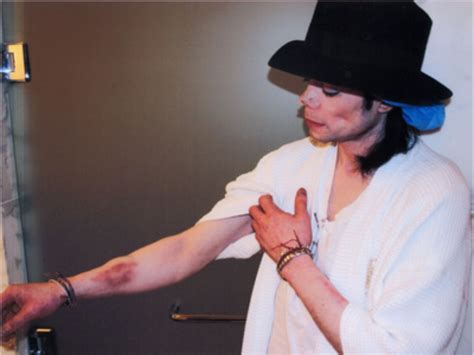 Weshalb Starb Michael Jackson Der Fall Des King Of Pop N Tvde