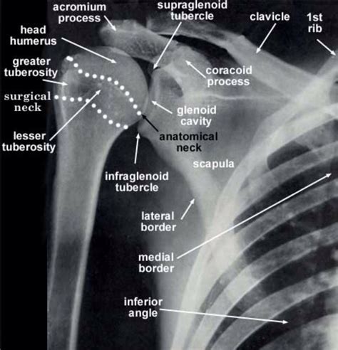 Ap Of The Glenohumeral Joint Radiology Schools Radiology Student