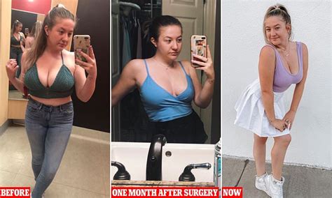 Singer Is Left Devastated After A Breast Reduction When They Grew Back
