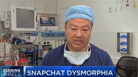 ‘snapchat Dysmorphia Plastic Surgeons Warn Of Devastating