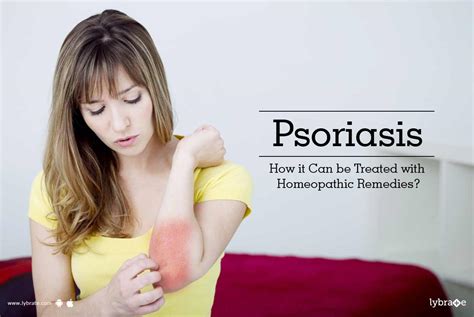 Psoriasis How It Can Be Treated With Homeopathic Remedies By Dr