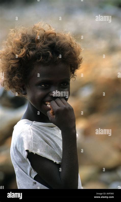 29 Best Photos Solomon Island Blonde Hair Minor Genetic Quirk Causes