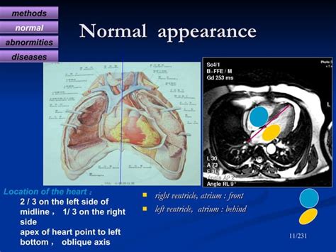 Diagnostic Radiology Of Cardiovascular 2009