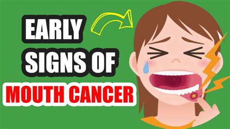 What Does Early Signs Of Mouth Cancer Look Like Oral Cancer