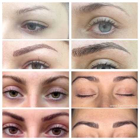 Before And After Microblading Eyebrows