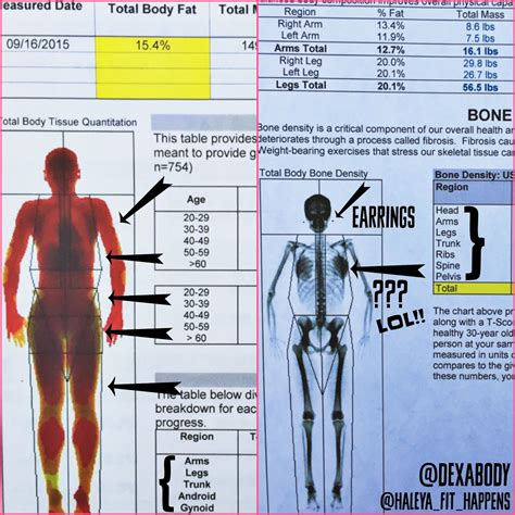 Ct scans take different amount of times depending on which part of the body is being scanned. Fit Happens: Dexa Scan Results