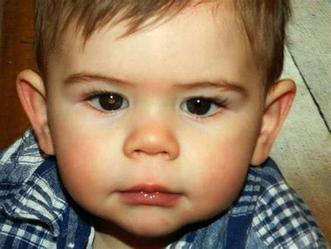 The pupil of the affected eye may look white in the photograph. Diagnóstico de cancer de ojo en los niños.