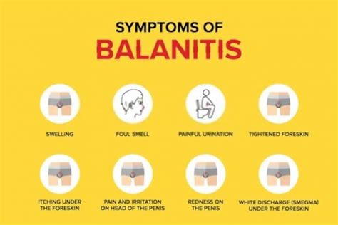Balanitis Won T Go Away Is It True Check This Ultimate Review