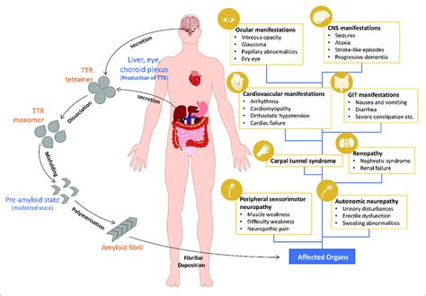 Pathogenesis And Clinical Manifestations Of Attr Amyloidosis