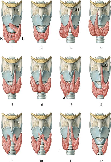 Illustration Of The Classi Wcation Of The Thyroid Gland Shapes 1 A