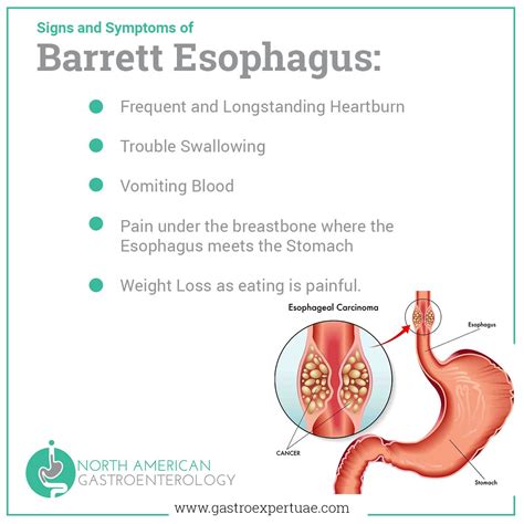 barrett s esophagus cancer symptoms