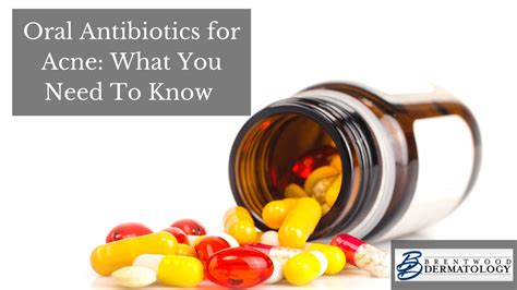 What You Should Know About Using Oral Antibiotics To Treat Acne