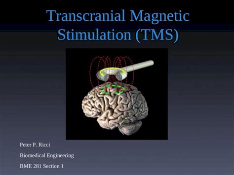 Ppt Transcranial Magnetic Stimulation Tms Peter P Ricci Biomedical