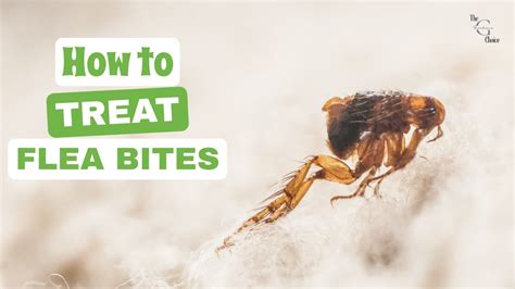 How To Treat Flea Bites In 3 Easy Steps Get Rid Of Fleas In Your Home