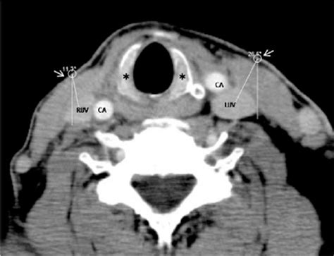 Axial Ct Anatomy