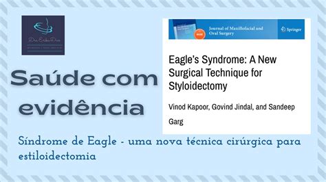 Saúde Com Evidência Síndrome De Eagle Uma Nova Técnica Cirúrgica