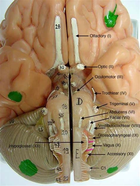 Cranialnervesonmodelslabeled Brain Model Somso Brain Anatomy