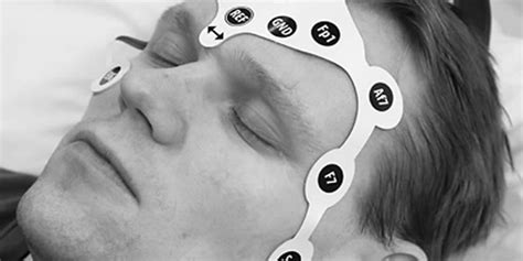 New Eeg Electrode Set For Fast And Easy Measurement Of Brain Function