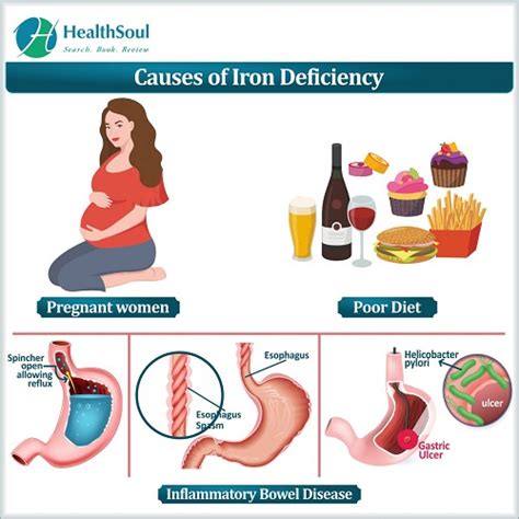 Signs And Symptoms Of Iron Deficiency Healthsoul