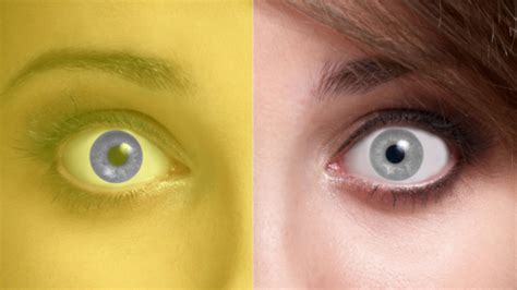 Flowers symbolize life, love and beauty. Does This Lady Have Two Different Colored Eyes?