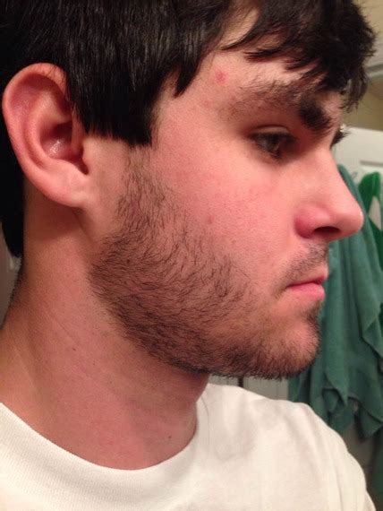 I am very tense because of my beard problem. First time beard grower! 18 need opinions - Beard Board