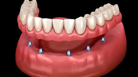 Benefícios do Protocolo Dentário saiba quais são Dental Arte