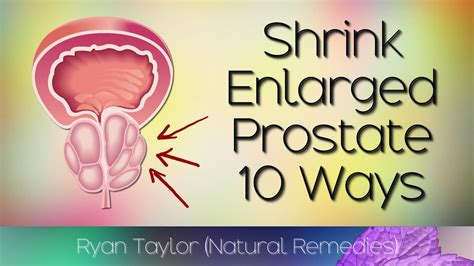 Shrink Enlarged Prostate Natural Remedies Youtube