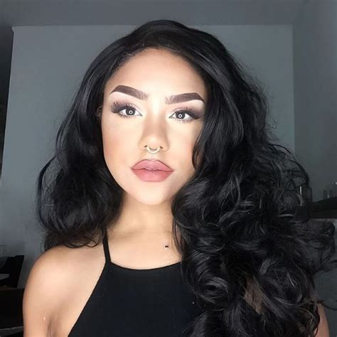 The patches of skin affected become white and usually have sharp margins. Vitiligo: Lauren's Story