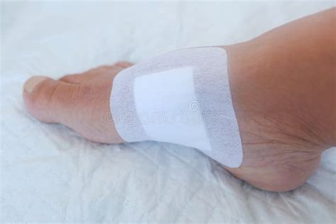 Closeup White Plaster On Skin Healing Wound Treatment Ulcer On Female