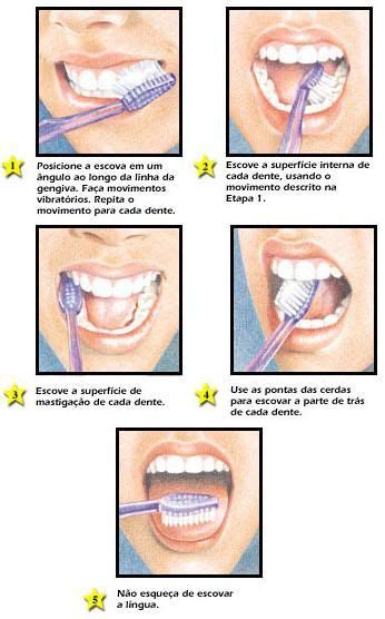 Passo A Passo De Como Escovar Os Dentes