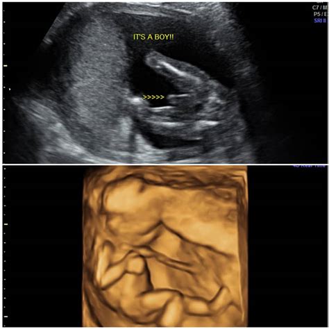 ultrasound combo packages inside view 3d 4d ultrasound