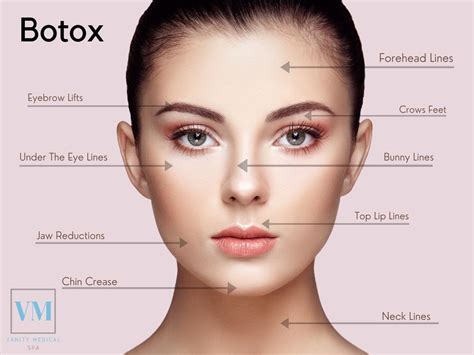 Botox Treatment In Teaneck Nj Call Vanity Medical Spa Now