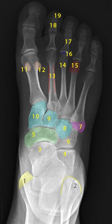 Normal radiographic anatomy of the foot | Radiology Case | Radiopaedia