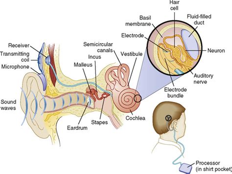 Anesthesia For Pediatric Otorhinolaryngologic Surgery Anesthesia Key