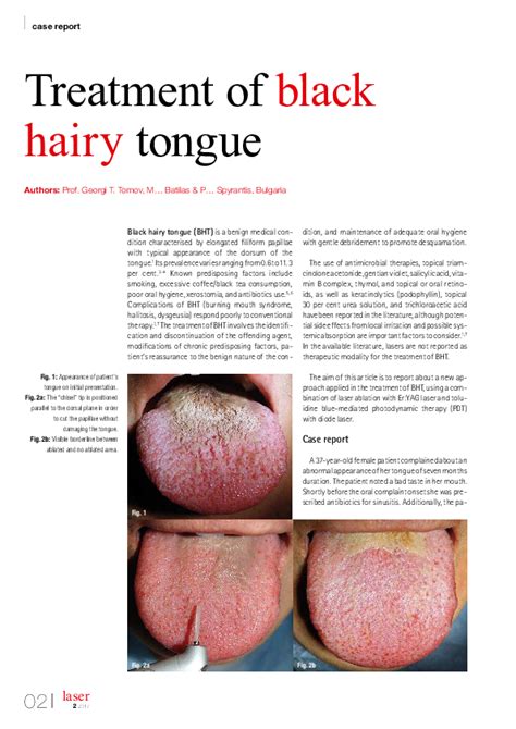 How To Cure Hairy Tongue Familiarcommission