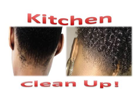 148 Natural Hair Nape Hair Maintenance Esp For Kinkycoilytype 4