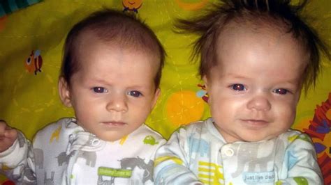 North Dakota Mom Gives Birth To Twin Boys And Only One Has Dwarfism