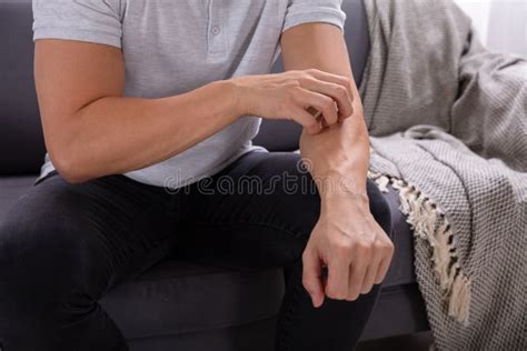 Man Suffering From Itching Skin Close Up Stock Image Image Of Itchy