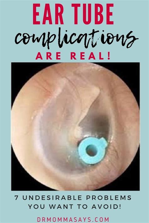 Avoid 7 Undesirable Ear Tube Complications With Routine Checkups Dr